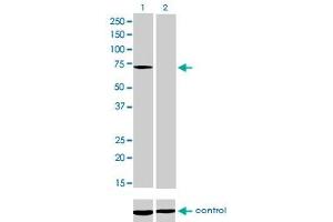 Western blot analysis of MTM1 over-expressed 293 cell line, cotransfected with MTM1 Validated Chimera RNAi (Lane 2) or non-transfected control (Lane 1).