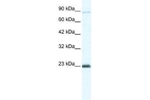 MCM4 antibody used at 5 ug/ml to detect target protein. (MCM4 抗体  (C-Term))