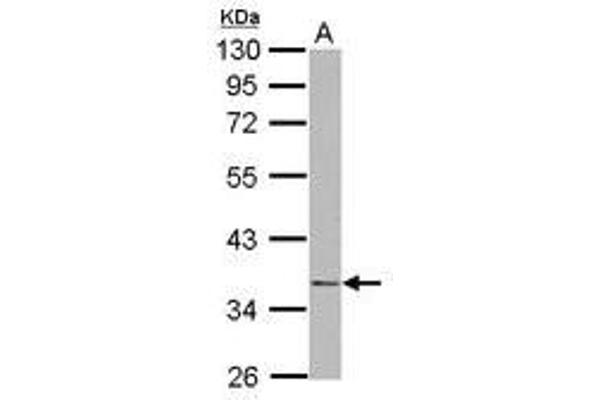 NudE Neurodevelopment Protein 1 (NDE1) (AA 1-203) 抗体