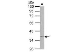 Image no. 1 for anti-NudE Neurodevelopment Protein 1 (NDE1) (AA 1-203) antibody (ABIN1499654) (NudE Neurodevelopment Protein 1 (NDE1) (AA 1-203) 抗体)
