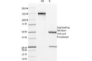 SDS-PAGE Analysis Purified Cyclin B1 Mouse Monoclonal Antibody (V92. (Cyclin B1 抗体)