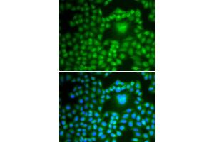 Immunofluorescence analysis of U2OS cell using PPP1CB antibody. (PPP1CB 抗体)