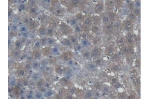 DAB staining on IHC-P; Samples: Rat Liver Tissue (AGXT 抗体  (AA 182-371))