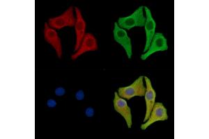 ABIN7096982 and ABIN7101049 staining Hela cells by IF/ICC. (PROZ 抗体)