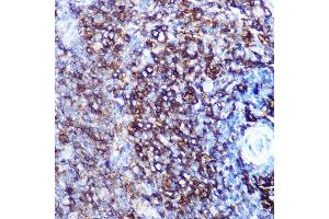 Immunohistochemistry of paraffin-embedded rat spleen using HLA-DQ Rabbit mAb (1252) at dilution of 1:100 (40x lens). (HLA-DQA1 抗体)
