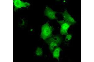Anti-C21orf59 mouse monoclonal antibody (ABIN2453835) immunofluorescent staining of COS7 cells transiently transfected by pCMV6-ENTRY C21orf59 (RC200169). (C21orf59 抗体)