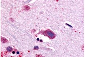 Anti-NTSR1 antibody  ABIN1049156 IHC staining of human brain, neurons and glia. (NTSR1 抗体  (C-Term))
