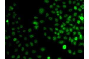 Immunofluorescence analysis of A549 cell using TRPS1 antibody. (TRPS1 抗体)