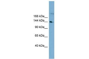 WB Suggested Anti-WDR35 Antibody Titration: 0. (WDR35 抗体  (N-Term))
