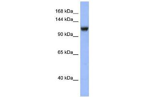 WB Suggested Anti-NR3C2 Antibody Titration: 0. (NR3C2 抗体  (N-Term))