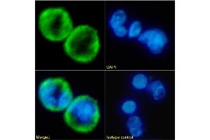 Immunofluorescence staining of fixed human peripheral blood leukocytes with anti-IL-8RA antibody SE2. (Recombinant CXCR2 抗体  (N-Term))