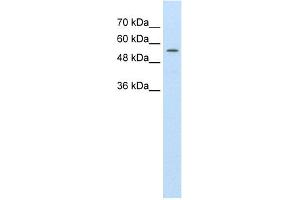 WB Suggested Anti-ABCD4 Antibody Titration:  1.