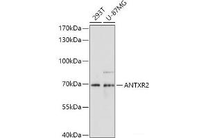 Western blot analysis of extracts of various cell lines using ANTXR2 Polyclonal Antibody at dilution of 1:1000. (ANTXR2 抗体)