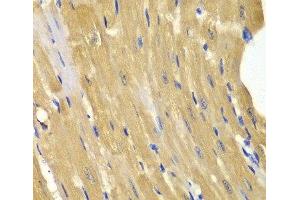 Immunohistochemistry (Paraffin-embedded Sections) (IHC (p)) image for anti-Adenylate Kinase 1 (AK1) antibody (ABIN7255966)