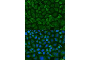 Immunofluorescence analysis of U2OS cells using MT-CO1 antibody (ABIN2561977) at dilution of 1:100. (COX1 抗体)