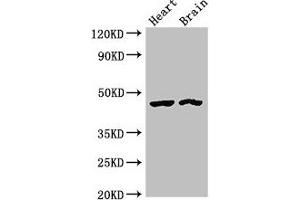 Western Blot Positive WB detected in: Rat heart tissue, Mouse brain tissue All lanes: CTH antibody at 4 μg/mL Secondary Goat polyclonal to rabbit IgG at 1/50000 dilution Predicted band size: 45, 40, 42 kDa Observed band size: 45 kDa (CTH 抗体  (AA 1-70))