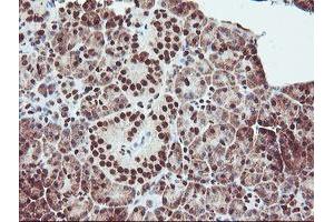 Image no. 7 for anti-Exosome Component 7 (EXOSC7) antibody (ABIN1498140)