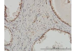 Image no. 1 for anti-Zinc Finger Protein 202 (ZNF202) (AA 301-401) antibody (ABIN599015) (ZNF202 抗体  (AA 301-401))