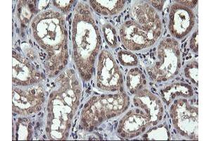 Image no. 2 for anti-Parvin, alpha (PARVA) antibody (ABIN1496442) (Parvin alpha 抗体)