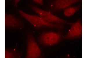 Immunofluorescence staining of methanol-fixed HeLa cells using c-Abl (phospho-Tyr412) antibody. (ABL1 抗体  (pTyr412))
