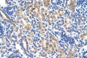 Image no. 1 for anti-Aldehyde Dehydrogenase 3 Family, Member A2 (ALDH3A2) (AA 351-400) antibody (ABIN6736668) (ALDH3A2 抗体  (AA 351-400))