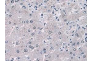 Detection of FABP1 in Human Liver Tissue using Monoclonal Antibody to Fatty Acid Binding Protein 1 (FABP1) (FABP1 抗体  (AA 2-127))