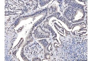 IHC analysis of TPR using anti-TPR antibody (ABIN7603243). (TPR 抗体  (N-Term))