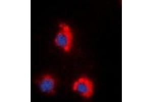 Immunofluorescent analysis of ZAP70 (pY319) staining in HeLa cells. (ZAP70 抗体  (pTyr319))