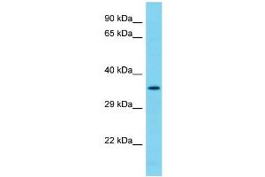 Host: Rabbit Target Name: NDUFAF7 Sample Type: 293T Whole Cell lysates Antibody Dilution: 1. (NDUFAF7 抗体  (C-Term))