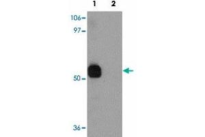 Western blot analysis of SPTLC2 in NIH/3T3 cell lysate with SPTLC2 polyclonal antibody  at 1 ug/mL in (1) the absence and (2) the presence of blocking peptide. (SPTLC2 抗体  (C-Term))