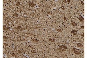 ABIN6279449 at 1/100 staining Rat brain tissue by IHC-P. (Gon-4-Like 抗体  (N-Term))