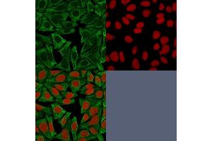 Confocal Immunofluorescence image of HeLa cells using Cytokeratin 18 Mouse Monoclonal Antibody (DE-K18) Green (CF488) and Reddot is used to label the nuclei. (Cytokeratin 18 抗体)