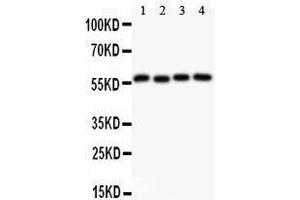 Observed bind size: 56KD (Cyclin B1 抗体  (AA 1-433))