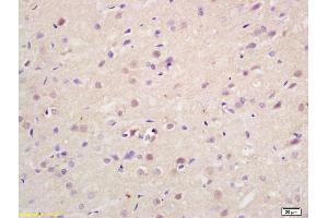 Formalin-fixed and paraffin embedded rat brain labeled with Rabbit Anti Exportin-2 Polyclonal Antibody, Unconjugated (ABIN737331) at 1:200 followed by conjugation to the secondary antibody and DAB staining (Exportin 2 抗体  (AA 901-971))