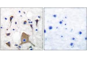 Immunohistochemistry (IHC) image for anti-Glutamate Receptor, Ionotropic, Kainate 1 (GRIK1) (AA 10-59) antibody (ABIN2889205) (GRIK1 抗体  (AA 10-59))