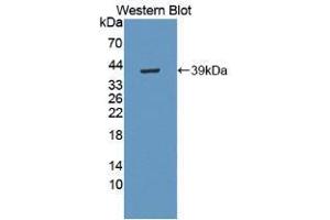Western blot analysis of recombinant Human MBP.