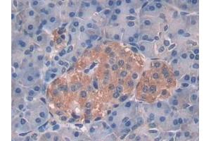 Immunohistochemistry (IHC) image for anti-Interleukin 10 (IL10) (AA 19-178) antibody (ABIN7442330)