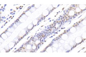 Detection of NPM1 in Human Colon Tissue using Polyclonal Antibody to Nucleophosmin 1 (NPM1)