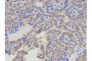 Immunohistochemistry (IHC) image for anti-5-Aminoimidazole-4-Carboxamide Ribonucleotide Formyltransferase/IMP Cyclohydrolase (ATIC) antibody (ABIN1876739) (ATIC 抗体)
