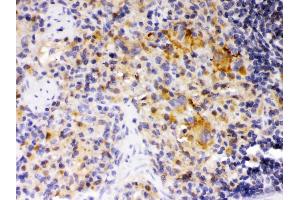 SKAP55 was detected in paraffin-embedded sections of rat spleen tissues using rabbit anti- SKAP55 Antigen Affinity purified polyclonal antibody at 1 μg/mL. (SKAP1 抗体  (Middle Region))