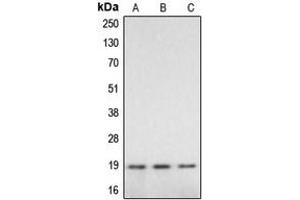 Western blot analysis of Caspase 2 p18 expression in HeLa (A), mouse liver (B), rat liver (C) whole cell lysates. (Caspase 2 p18 抗体  (Center))
