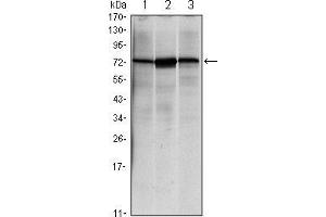 Western blot analysis using HSPA5 mouse mAb against NIH/3T3 (1), Hela (2) and Jurkat (3) cell lysate. (GRP78 抗体)