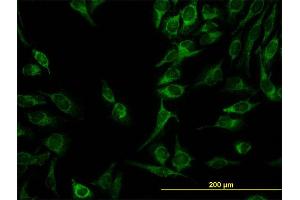 Immunofluorescence of monoclonal antibody to C21orf33 on HeLa cell. (C21orf33 抗体  (AA 188-268))