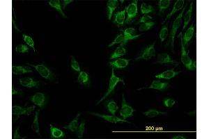 Immunofluorescence of monoclonal antibody to C21orf33 on HeLa cell.