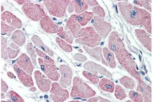 Human Heart (formalin-fixed, paraffin-embedded) stained with CLIC4 antibody ABIN337111 at 5 ug/ml followed by biotinylated anti-goat IgG secondary antibody ABIN481715, alkaline phosphatase-streptavidin and chromogen. (CLIC4 抗体  (AA 8-20))