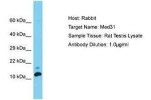 Image no. 1 for anti-Mediator Complex Subunit 31 (MED31) (C-Term) antibody (ABIN6750371) (MED31 抗体  (C-Term))