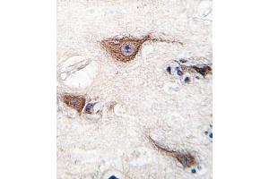 Immunohistochemistry (IHC) image for anti-Ubiquitin Carboxyl-terminal Esterase L1 (Ubiquitin Thiolesterase) (UCHL1) antibody (ABIN3001459)