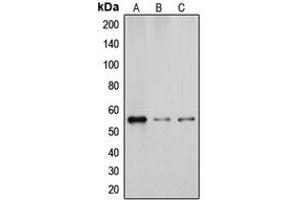 Western Blotting (WB) image for anti-Cytochrome P450, Family 2, Subfamily D, Polypeptide 6 (CYP2D6) (Center) antibody (ABIN7295450)