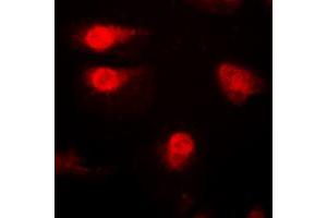 Immunofluorescent analysis of p27 Kip1 (pT187) staining in A431 cells. (CDKN1B 抗体  (C-Term, pSer187))