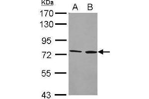 WB Image Sample (20 ug) A: Hela whole cell lysate B: Hela cell membrane 7. (CYP4F2 抗体  (Internal Region))